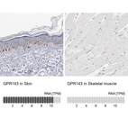 Anti-GPR143 Antibody