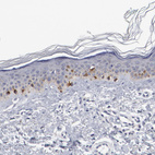 Anti-GPR143 Antibody