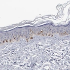 Immunohistochemical staining of human skin shows moderate to strong cytoplasmic positivity in melanocytes.