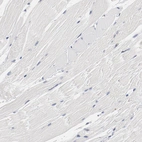 Immunohistochemical staining of human skeletal muscle shows no positivity in striated muscle fibers as expected.