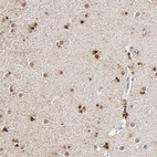 Anti-RGAG4 Antibody