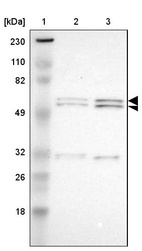 Lane 1: Marker [kDa] 230, 110, 82, 49, 32, 26, 18_br/_Lane 2: Human cell line RT-4_br/_Lane 3: Human cell line U-251MG sp