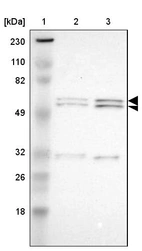 Lane 1: Marker [kDa] 230, 110, 82, 49, 32, 26, 18_br/_Lane 2: Human cell line RT-4_br/_Lane 3: Human cell line U-251MG sp