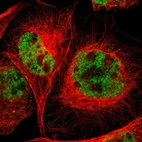 Immunofluorescent staining of human cell line A-431 shows localization to nucleoplasm.