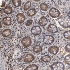 Anti-PNPLA4 Antibody