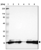 Lane 1: Marker [kDa] 230, 110, 82, 49, 32, 26, 18_br/_Lane 2: Human cell line RT-4_br/_Lane 3: Human cell line U-251MG sp_br/_Lane 4: Human plasma (IgG/HSA depleted)_br/_Lane 5: Human liver tissue_br/_Lane 6: Human tonsil tissue