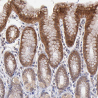 Anti-OAS1 Antibody