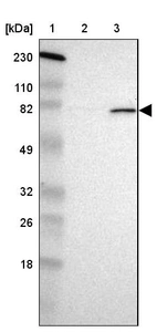 Lane 1: Marker [kDa] 230, 110, 82, 49, 32, 26, 18_br/_Lane 2: Human cell line RT-4_br/_Lane 3: Human cell line U-251MG sp