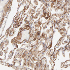 Anti-NPNT Antibody