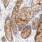Immunohistochemical staining of human Rectum shows moderate positivity in extracellular matrix in goblet cells.