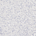 Anti-NPNT Antibody