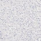 Immunohistochemical staining of human Liver shows very weak positivity in extracellular matrix in hepatocytes.