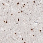 Immunohistochemical staining of human cerebral cortex shows nuclear positivity in neuronal cells.