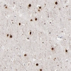 Immunohistochemical staining of human cerebral cortex shows nuclear positivity in neuronal cells.