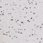 Immunohistochemical staining of human cerebral cortex shows strong nuclear immunoreactivity in neurons.