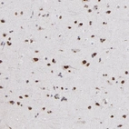 Immunohistochemical staining of human cerebral cortex shows strong nuclear immunoreactivity in neurons.