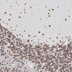 Immunohistochemical staining of human cerebellum shows nuclear positivity in Purkinje cells, as well as in the molecular and granular cell layers.