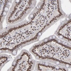 Immunohistochemical staining of human duodenum shows strong nuclear positivity in glandular cells.