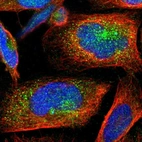 Immunofluorescent staining of human cell line U-2 OS shows localization to vesicles.