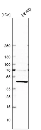 Western blot analysis in human cell line BEWO.