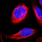 Immunofluorescent staining of human cell line U-2 OS shows localization to nucleoli fibrillar center.