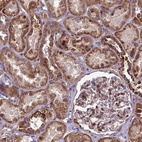 Anti-RSPRY1 Antibody