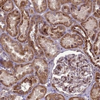 Anti-RSPRY1 Antibody