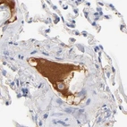 Immunohistochemical staining of human lung using Anti-APOH antibody HPA003732.