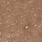 Immunohistochemical staining of human cerebral cortex shows strong cytoplasmic positivity in neuropil.