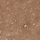 Immunohistochemical staining of human cerebral cortex shows strong cytoplasmic positivity in neuropil.