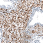 Immunohistochemical staining of human prostate shows strong cytoplasmic positivity in smooth muscle cells.
