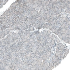 Immunohistochemical staining of human pancreas shows no positivity in exocrine glandular cells as expected.