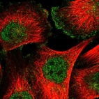 Immunofluorescent staining of human cell line U-251 MG shows localization to nucleus & plasma membrane.