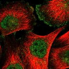 Immunofluorescent staining of human cell line U-251 MG shows localization to nucleus & plasma membrane.