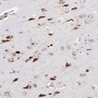 Anti-RRAGA Antibody