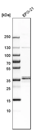 Western blot analysis in human cell line EFO-21.