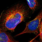 Immunofluorescent staining of human cell line U-2 OS shows localization to the Golgi apparatus & vesicles.