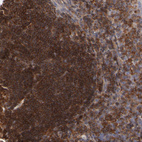 Immunohistochemical staining of human tonsil shows strong cytoplasmic positivity in germinal center cells.