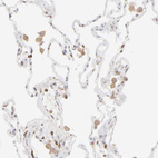 Immunohistochemical staining of human lung shows moderate cytoplasmic positivity in macrophages.