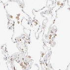 Immunohistochemical staining of human lung shows moderate cytoplasmic positivity in macrophages.