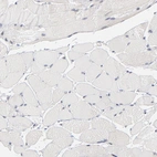 Immunohistochemical staining of human skeletal muscle shows no cytoplasmic positivity in myocytes as expected.