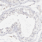 Immunohistochemical staining of human testis shows no cytoplasmic positivity in cells in seminiferous ducts as expected.