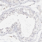 Immunohistochemical staining of human testis shows no cytoplasmic positivity in cells in seminiferous ducts as expected.