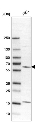 Western blot analysis in human cell line HEL.