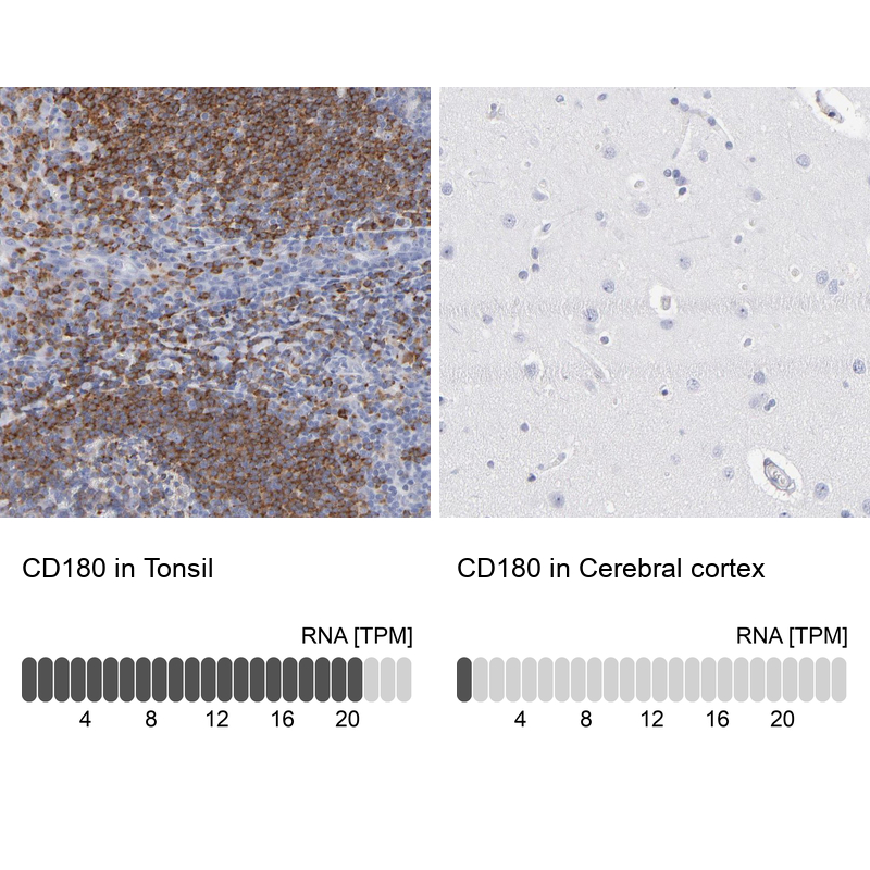 Anti-CD180 Antibody