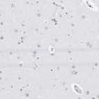 Anti-CD180 Antibody