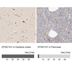 Anti-DYNC1H1 Antibody