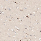Immunohistochemical staining of human cerebral cortex shows high expression.