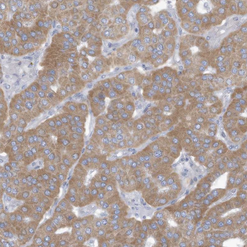 Anti-TRMT2B Antibody