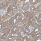 Anti-TRMT2B Antibody